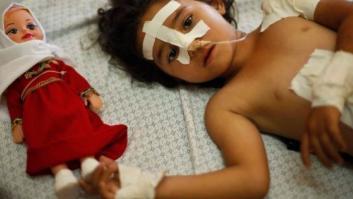 Los niños palestinos se enfrentan a las heridas y a la pérdida de sus familiares por los ataques aéreos