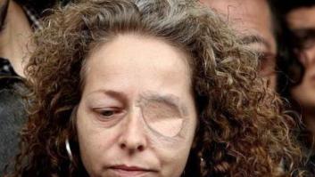 Absueltos los dos mossos acusados de reventar el ojo a Ester Quintana