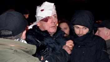 El exministro ucraniano Lutsenko, en la UCI tras una agresión policial durante la protesta de anoche