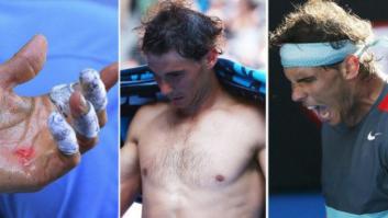 Open de Australia: Nadal pasa a semifinales tras sufrir contra Dimitrov
