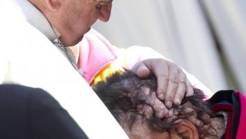 El último gesto del papa Francisco con una joven discapacitada (VÍDEO)