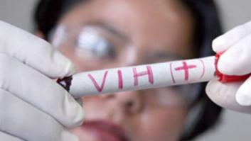 Descubren la 'ruta' que siguió el VIH para propagarse por el mundo