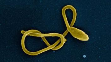 Uganda declara un brote de ébola tras confirmar la muerte de un paciente que dio positivo