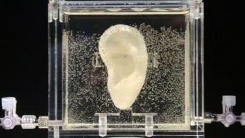 Reconstruyen la oreja de Van Gogh con células de un descendiente (FOTOS)