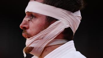 El judoca Alberto Gaitero acaba en este estado físico tras caer eliminado en los Juegos