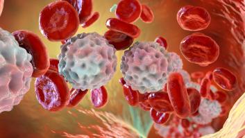 Un estudio con participación española completa el mapa genómico de la leucemia más común