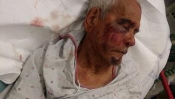 Un mexicano de 91 años sufre una paliza racista en California