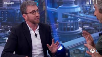 Pablo Motos habla del problema físico que padece: 