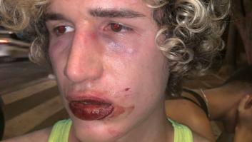 Un joven sufre una agresión homófoba a la salida de una discoteca en Valencia