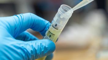 Cuál es la diferencia entre PCR, test de antígenos y test serológico
