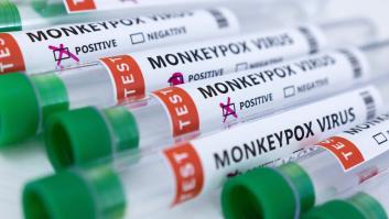 El productor de la vacuna contra la viruela del mono asegura que "hay suministros suficientes"