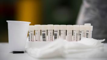 Un test "sencillo y barato" mide cuánto dura la protección de las vacunas contra el covid