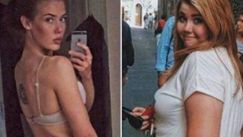 Una joven pierde 67 kilos gracias a una cucharilla de café y una dieta sana