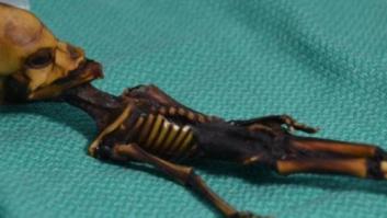 El misterioso esqueleto de Atacama muestra mutaciones que provocan el envejecimiento óseo