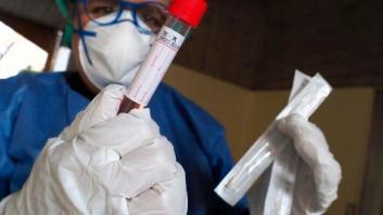 Los test rápidos de coronavirus comprados en China no funcionan bien