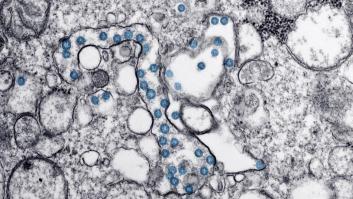 Investigadores del CSIC logran un nanomaterial que elimina el coronavirus