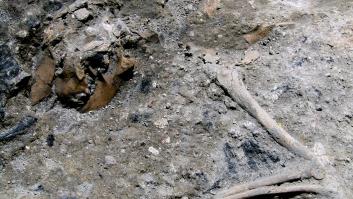 Hallan los restos de la primera amputación quirúrgica hace más 31.000 años