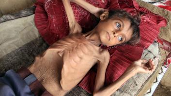 "Lo que era una ola de hambre es ahora un tsunami", advierte la ONU