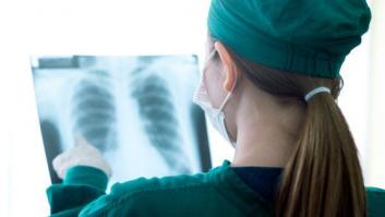 Una mujer muere de cáncer tras recibir un trasplante de pulmones de una fumadora