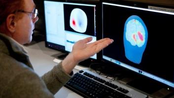 "Oleadas" de actividad neuronal dan nuevas pistas sobre la enfermedad de Alzheimer