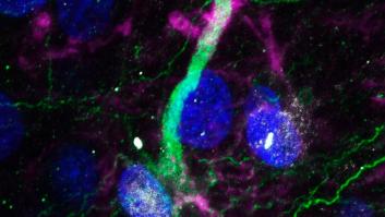 Demuestran la existencia de células madre en el cerebro que permiten generar neuronas toda la vida