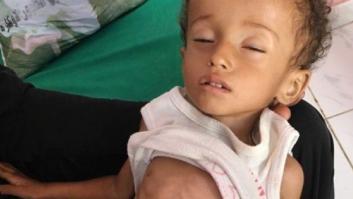La BBC logra documentar los estragos del cólera y el hambre en Yemen