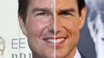 ¿Qué se ha hecho Tom Cruise en la cara?