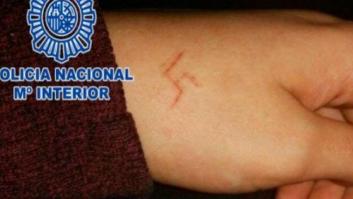 Seis detenidos en Madrid por marcar una esvástica a una chica con un objeto candente