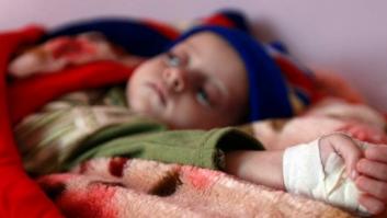 Un niño muere cada cinco segundos en el mundo por causas en su mayoría prevenibles, según la ONU