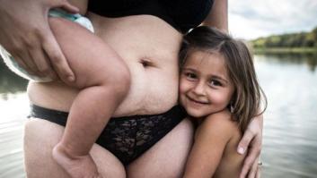 21 fotos para celebrar la belleza del cuerpo femenino después del parto