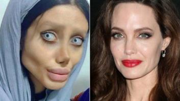 50 operaciones para ser como Angelina Jolie y termina pareciendo la novia cadáver