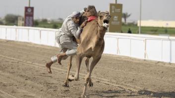 El virus del camello causa estragos en la selección francesa a dos días de la final, estos son sus síntomas