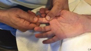 Bruno Hortelano enseña la mano por primera vez tras su grave accidente