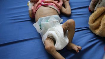La historia no contada de las víctimas más pequeñas de la brutal guerra en Yemen