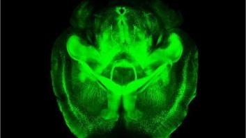 Clarity: científicos desarrollan una técnica para ver el cerebro transparente (VÍDEO)