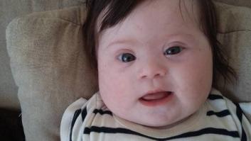 Louise, mi hija de cuatro meses, dos brazos, dos piernas y un cromosoma de más