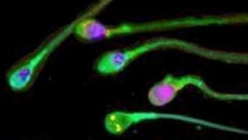 Alteraciones en la cola del espermatozoide pueden determinar la calidad del semen