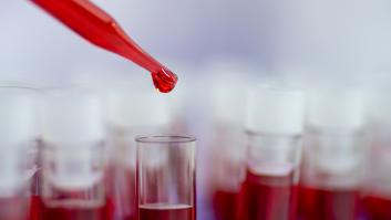 En qué consisten las biopsias líquidas, el gran avance en la detección del cáncer