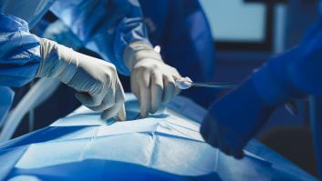 Un equipo de 20 cirujanos y asistentes extirpa un tumor de 4,2 kilos en Chile
