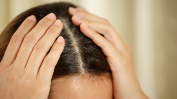 Productos para evitar la caída del pelo de manera efectiva