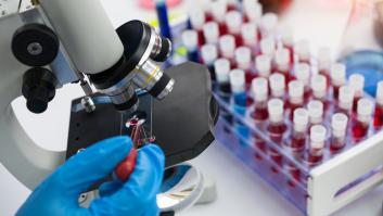 El análisis de ciertas proteínas en la sangre permite predecir qué órganos fallarán antes