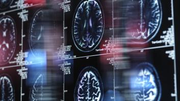 La ciencia descubre una nueva alerta temprana del Alzheimer en la visión