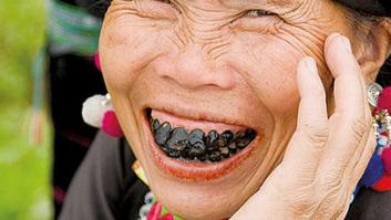 El único país del mundo en el que tener los dientes negros era símbolo de belleza