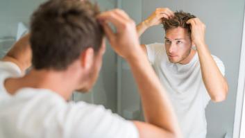 Caída de pelo en hombres: 5 productos para evitarla