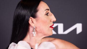 Rossy de Palma responde así a quienes se han metido con ella por su nariz: es ya de lo más compartido