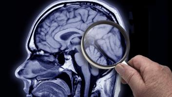 Una nueva investigación desmiente la percepción sobre la herencia del Alzheimer y piden centrar la atención hacia otro lado