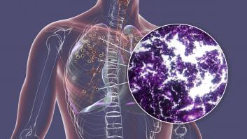 Sanidad confirma la vuelta de una enfermedad respiratoria incurable del pasado