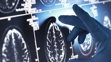 Los expertos alertan que el gran "asesino" del cerebro es este simple alimento: cada español devora 29 kilos por año