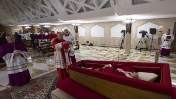 Un médico irrumpe en escena para explicar el fenómeno detrás de las manchas oscuras en la cara del papa