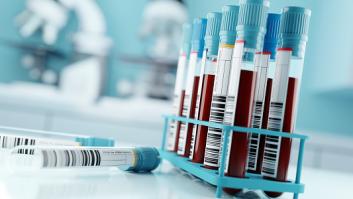 Los errores que se activan dos días antes de una analítica y que trastocan los valores del colesterol y azúcar en sangre
